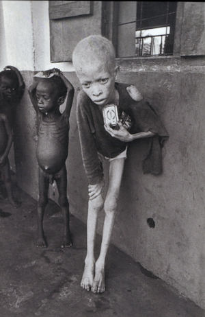 Biafran famine, news photo